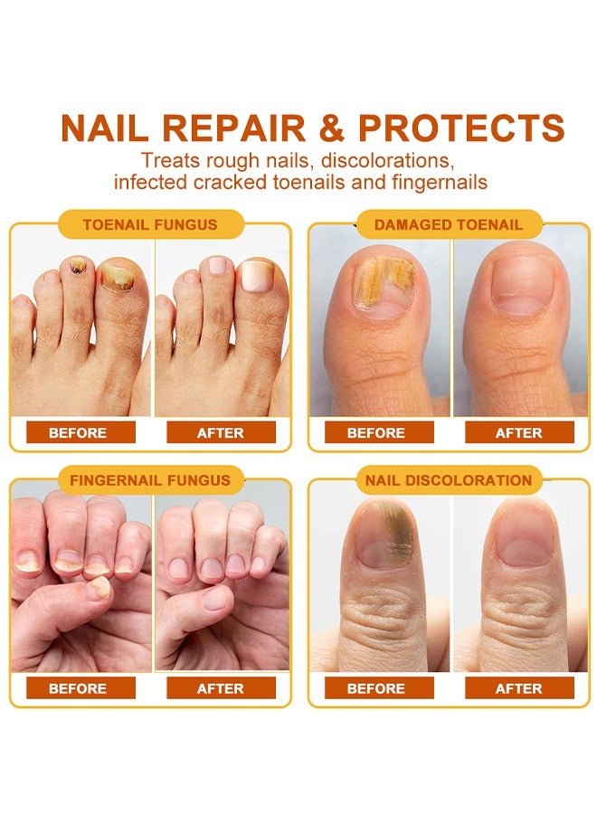 Sumifun - Bee Venom Fungal Nail Treatment Cream (Original)